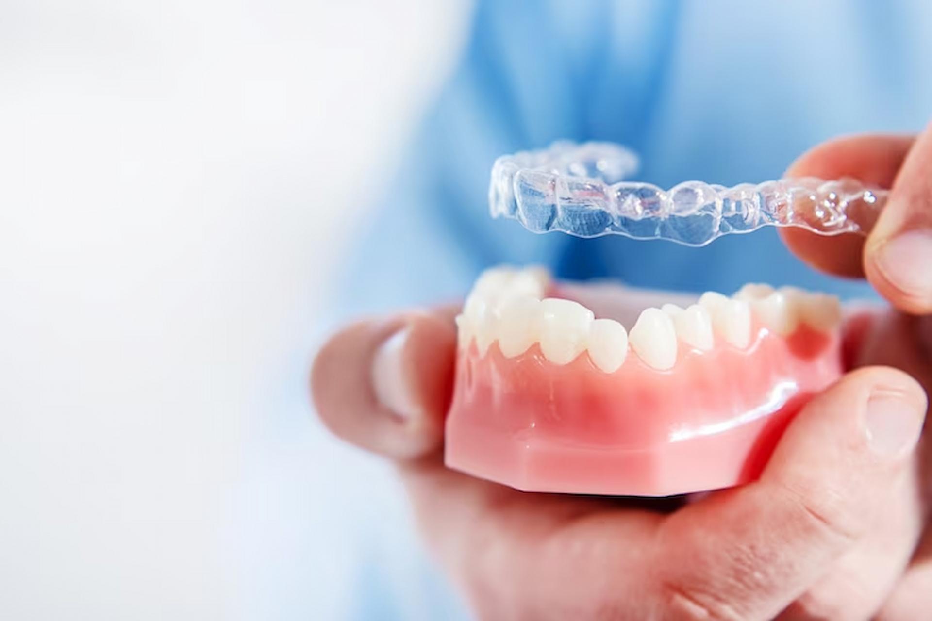 How does Invisalign compare with classic braces?
